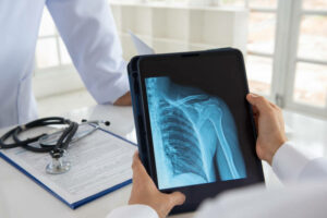 shoulder joint x-ray image on digital tablet with doctor team medical diagnose injuries of tendons and bones.
