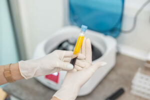 Close up od doctor's hands with surgical gloves while preparing blood collection tubes for centrifuge machine
