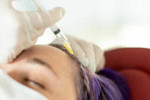 Cosmetologist does prp therapy against hair loss